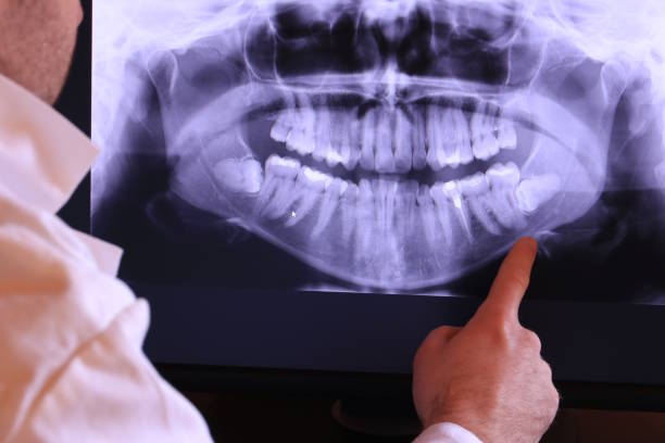 Best Cosmetic Emergency Dentistry in Portola, CA