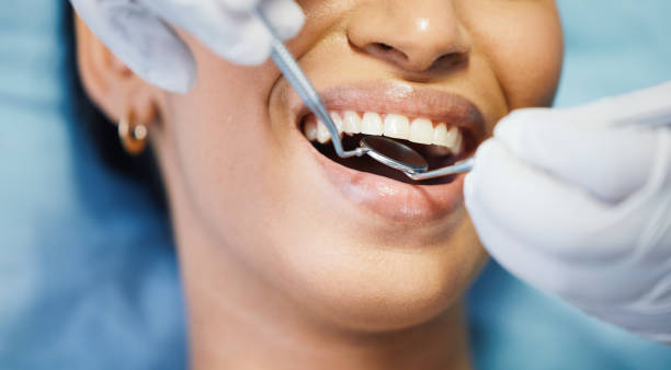 Best Emergency Gum Treatment in Portola, CA