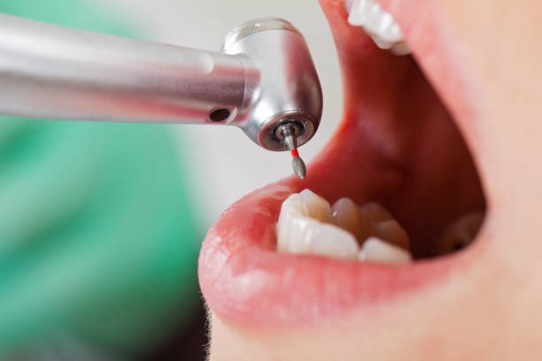 Best Cosmetic Emergency Dentistry in Portola, CA